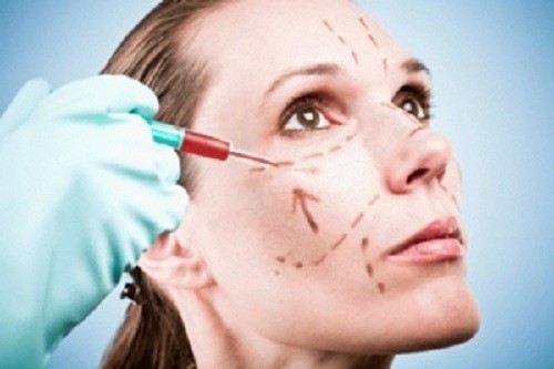 Provider injecting platelet-rich plasma into a woman's cheek along marked treatment lines